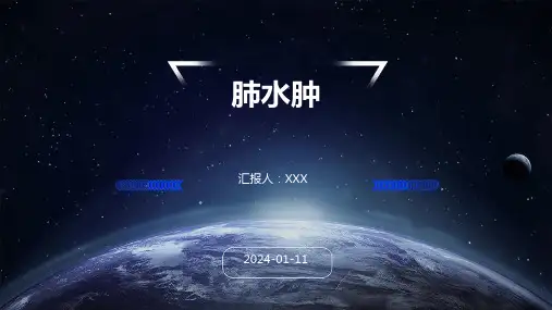 肺水肿PPT演示课件【30页】