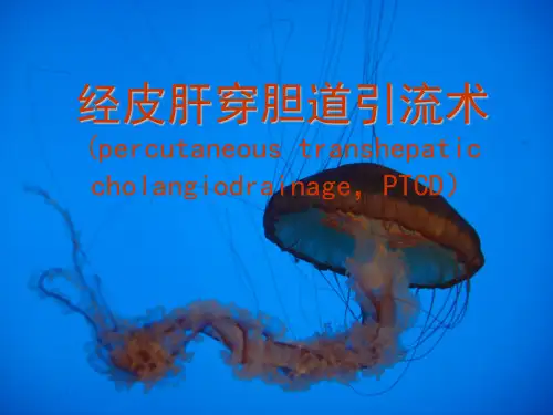 PTCD临床应用进展