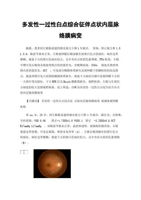 多发性一过性白点综合征伴点状内层脉络膜病变
