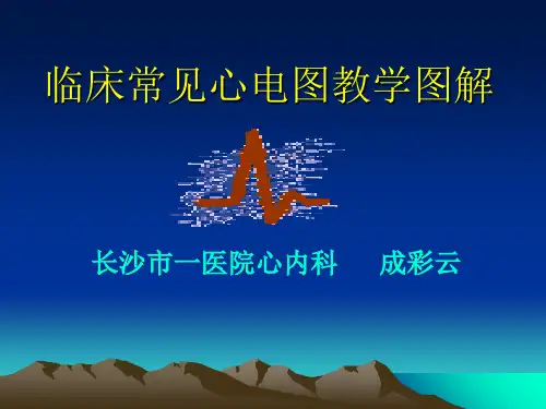 心电图基础知识ppt课件