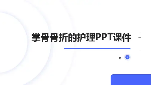 掌骨骨折的护理PPT课件