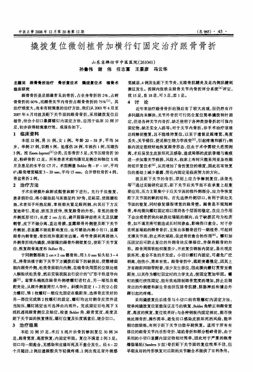 撬拨复位微创植骨加横行钉固定治疗跟骨骨折