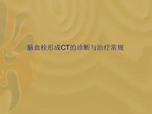 脑血栓形成CT的诊断与治疗常规
