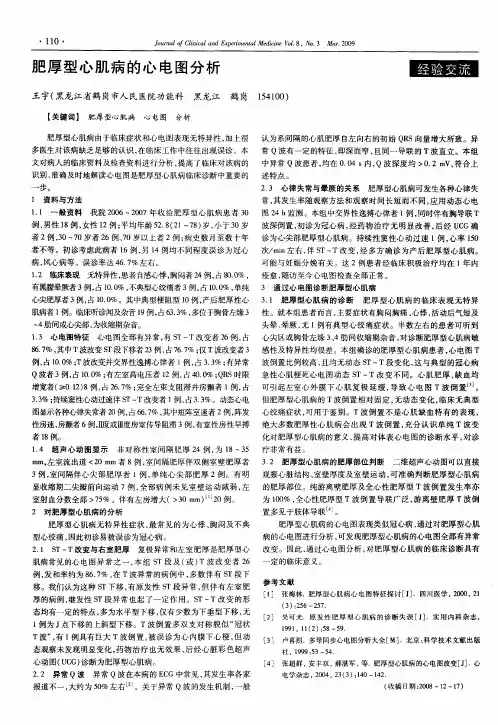 肥厚型心肌病的心电图分析