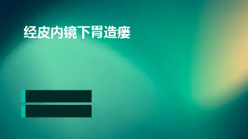经皮内镜下胃造瘘