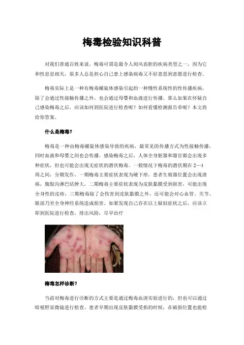 梅毒检验知识科普