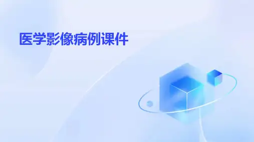 医学影像病例课件ppt