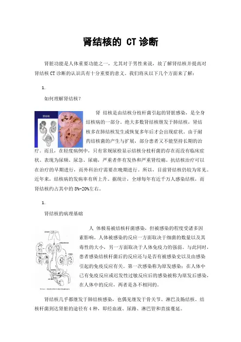 肾结核的CT诊断