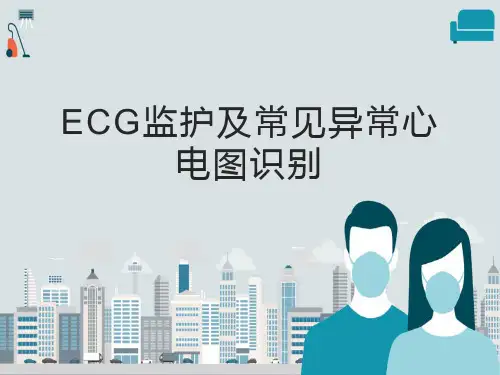 ECG监护及常见异常心电图的识别