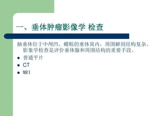 垂体肿瘤MRI诊断