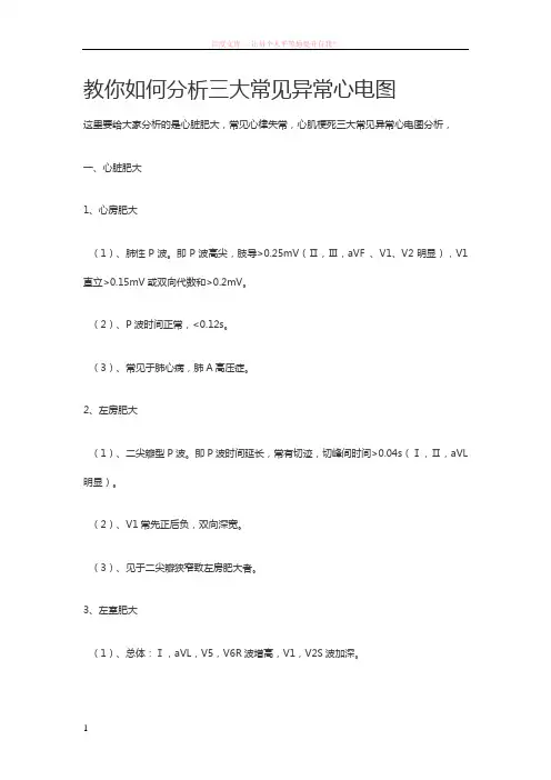 教你如何分析三大常见异常心电图