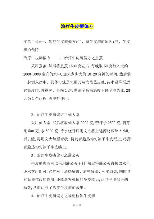 治疗牛皮癣偏方
