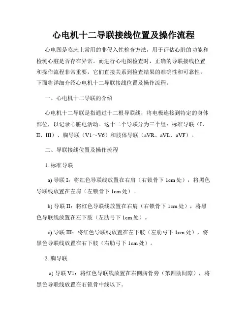 心电机十二导联接线位置及操作流程
