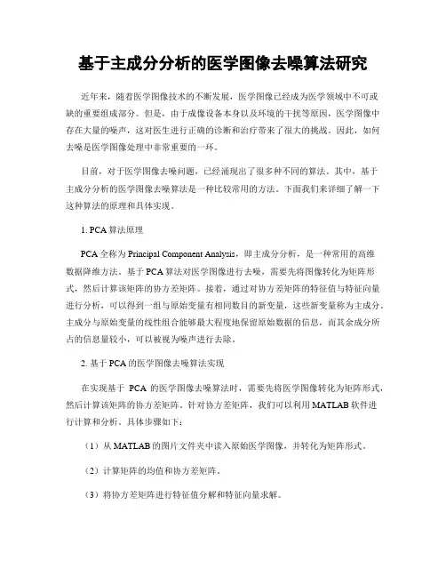 基于主成分分析的医学图像去噪算法研究