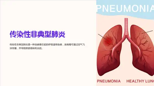 传染性非典型肺炎