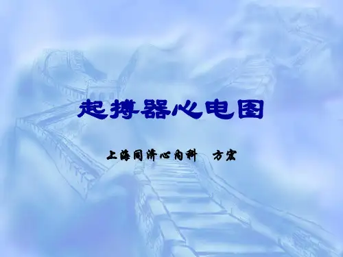 起搏器心电图-教学课件