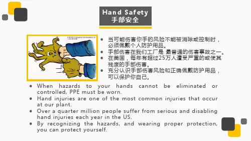手部安全培训资料
