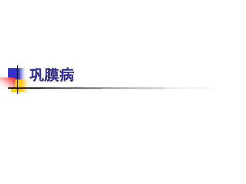 眼科学课件：巩膜病