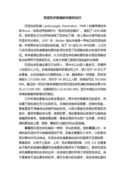 风湿性多肌痛的诊断和治疗