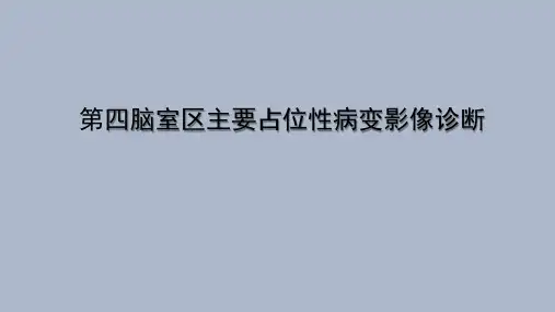 第四脑室区主要占位性病变影像