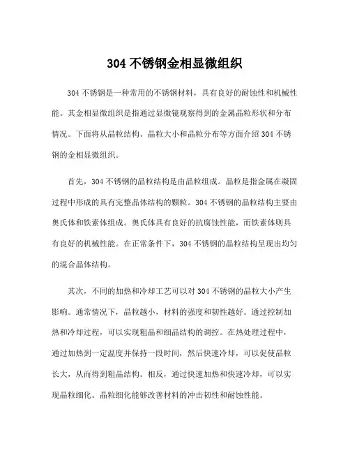304不锈钢金相显微组织