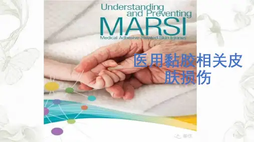 MARSI 医用黏胶相关皮肤损伤ppt课件