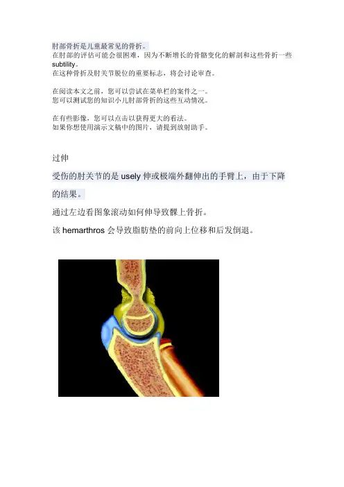 小儿肘关节X线诊断讲座