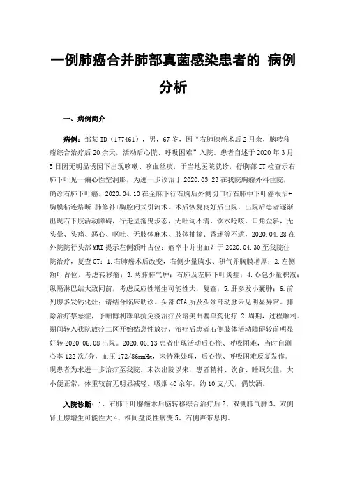 一例肺癌合并肺部真菌感染患者的病例分析