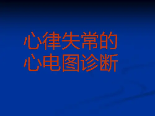 心律失常的心电图表现