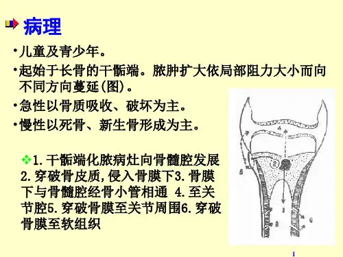 急性血源性骨髓炎