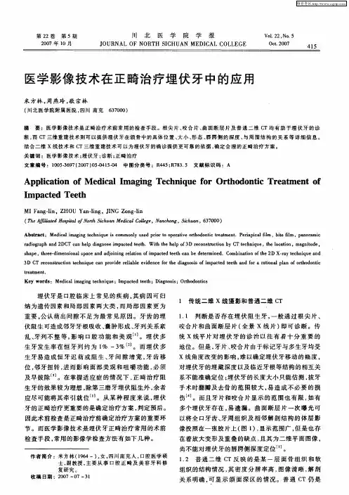 医学影像技术在正畸治疗埋伏牙中的应用