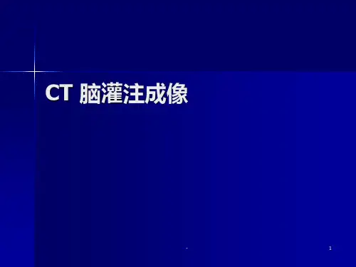 CT灌注成像PPT课件