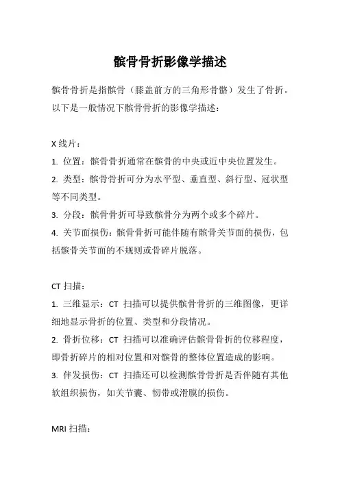 髌骨骨折影像学描述