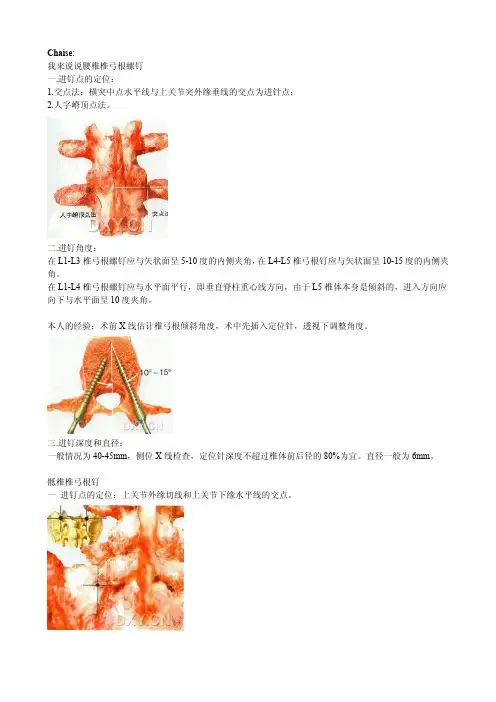 椎弓根钉技术