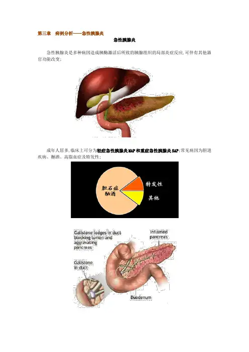 病例分析急性胰腺炎