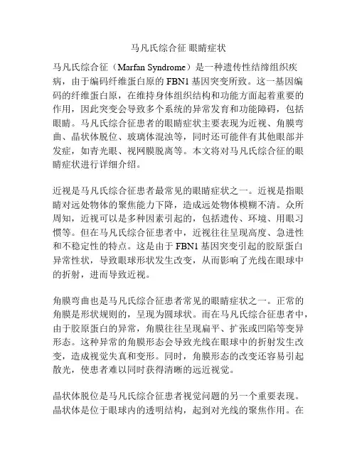 马凡氏综合征 眼睛症状