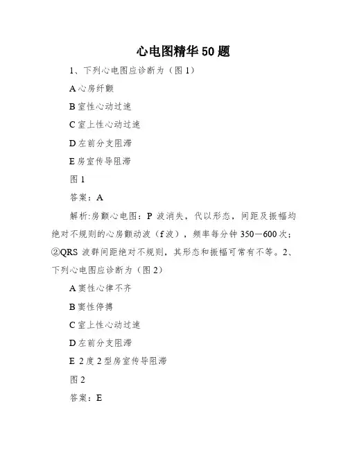 心电图精华50题