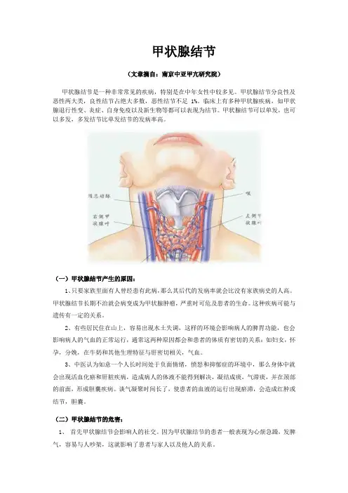甲状腺结节