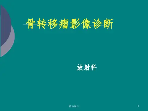 骨转移瘤影像诊断