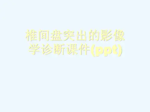 椎间盘突出的影像学诊断课件(ppt)