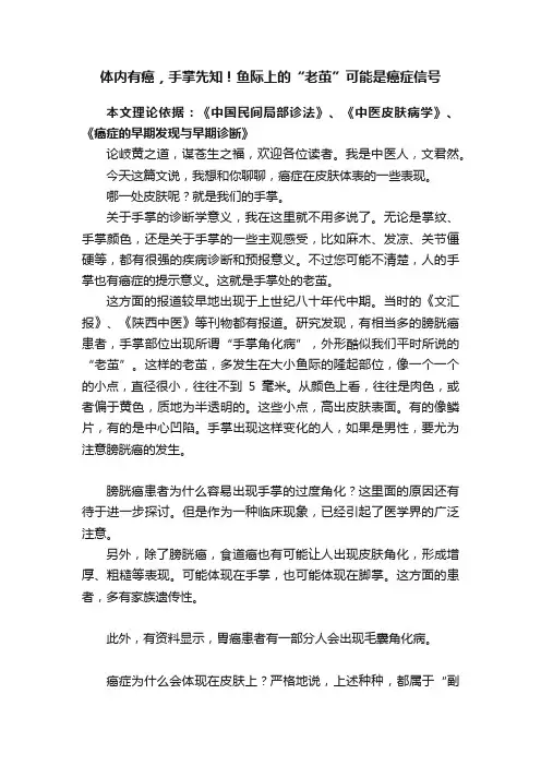体内有癌，手掌先知！鱼际上的“老茧”可能是癌症信号