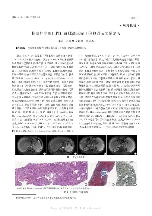 特发性非硬化性门静脉高压症1例报道及文献复习