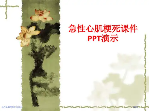 急性心肌梗死汇总演示