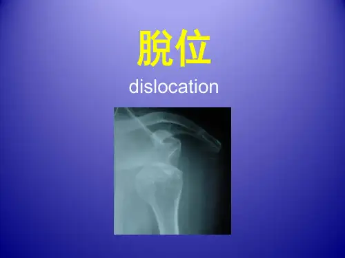 中医骨伤科学-脱位