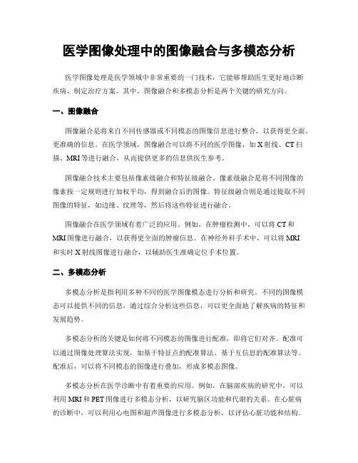 医学图像处理中的图像融合与多模态分析