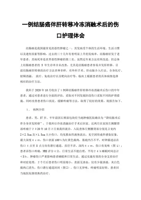 一例结肠癌伴肝转移冷冻消融术后的伤口护理体会