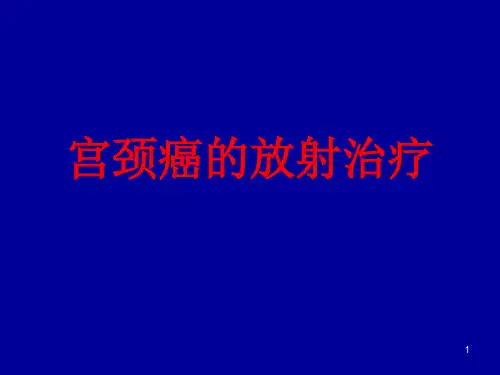 宫颈癌的放射治疗ppt课件