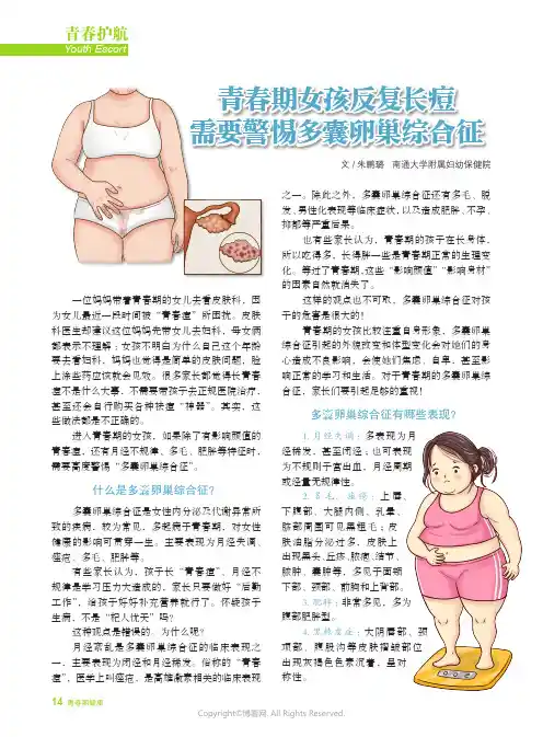 青春期女孩反复长痘_需要警惕多囊卵巢综合征