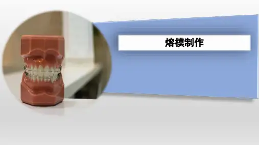 口腔医学技术：牙齿熔模的制作精选全文完整版