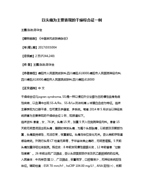 以头痛为主要表现的干燥综合征一例